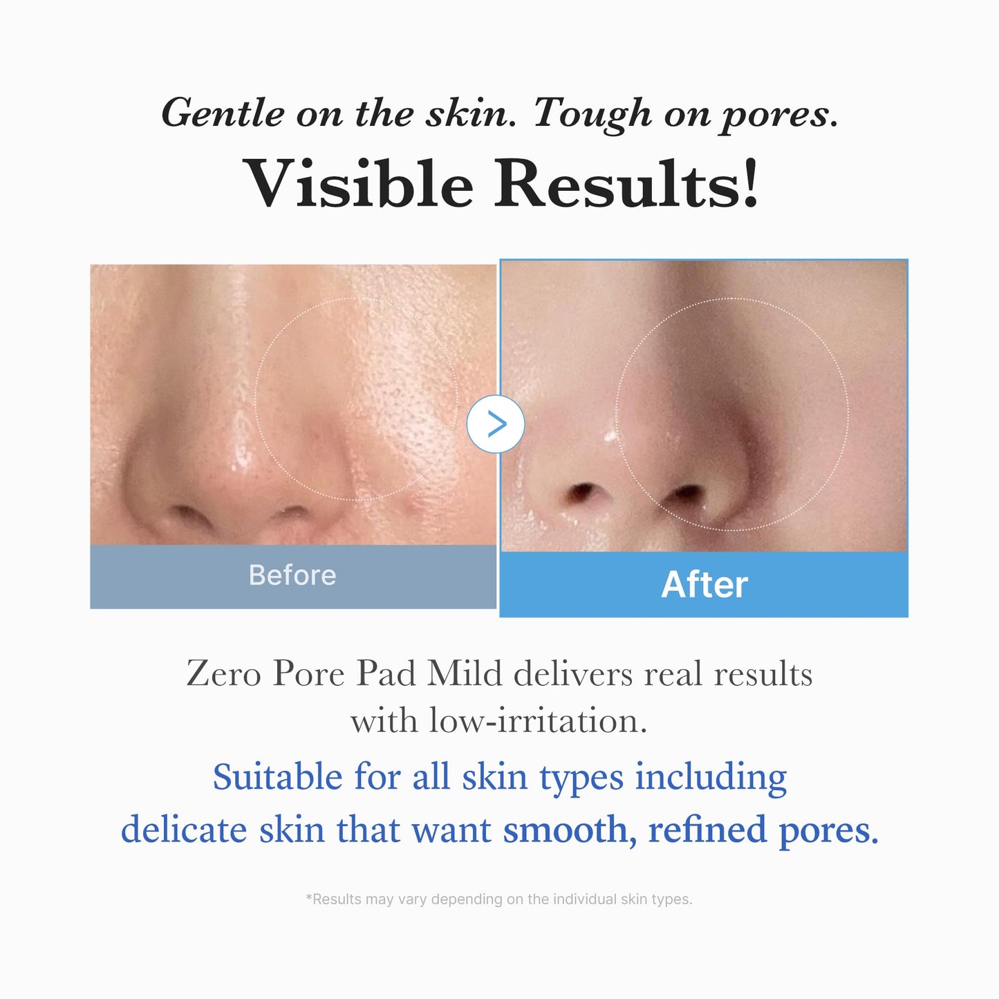 medicube Toner Pads Zero Pore Pad 2.0 for Exfoliation and Pore Care | Dual-Textured Facial Pad with 4.5% AHA Lactic Acid, 0.45% BHA Salicylic Acid - For All, Korean Skin Care, 70 Pads, 1 Pack